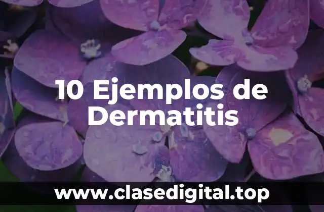 10 Ejemplos de Dermatitis