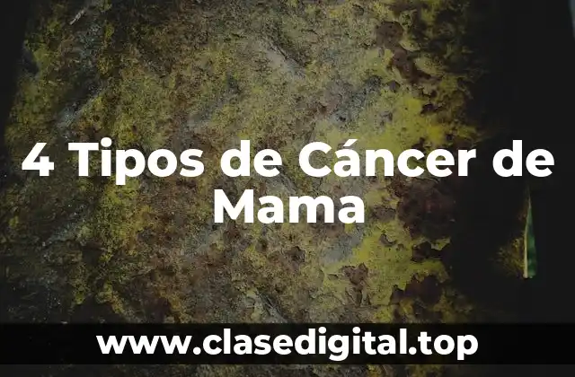 ¿Qué es el Cáncer de Mama Infiltrante Ductal (CID)?