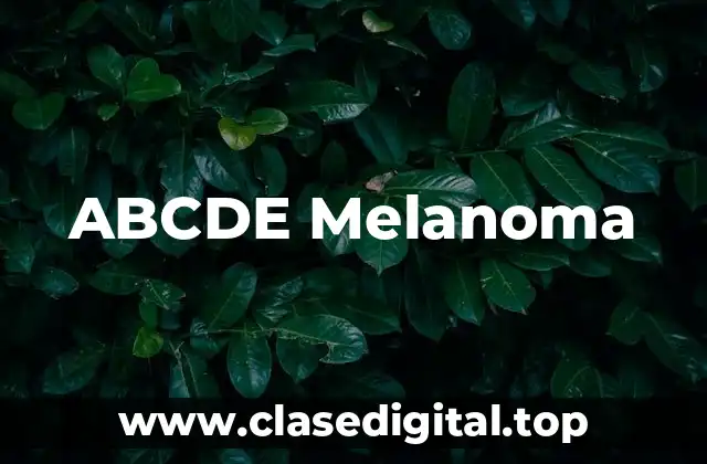 ¿Qué es el melanoma ABCDE?