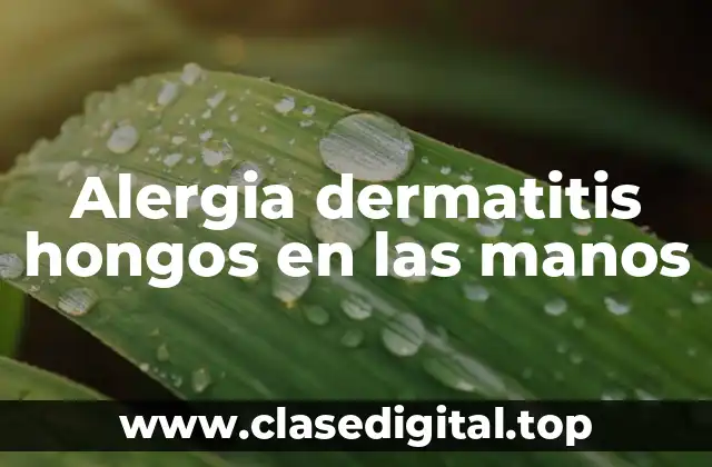 ¿Qué son los Hongos que Causan Alergia en las Manos?