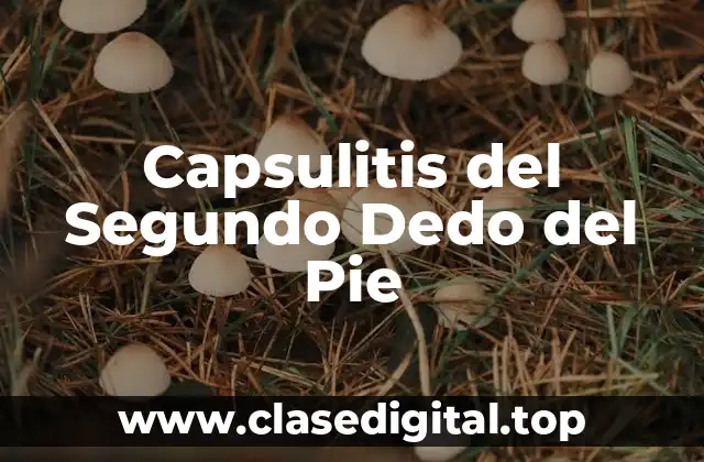 Capsulitis del Segundo Dedo del Pie