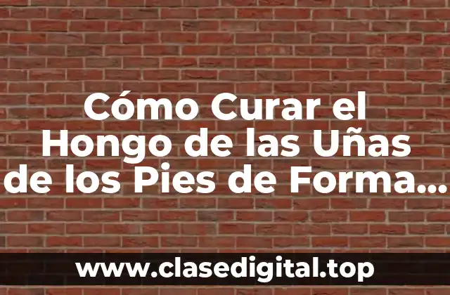 Cómo Curar el Hongo de las Uñas de los Pies de Forma Natural y Efectiva