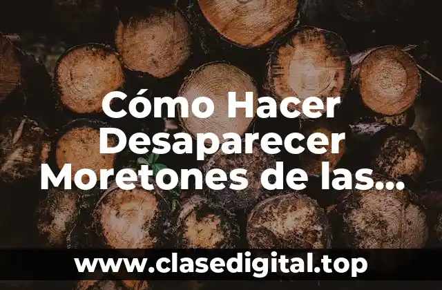 Cómo Hacer Desaparecer Moretones de las Piernas