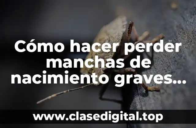 Cómo hacer perder manchas de nacimiento graves como berrugas