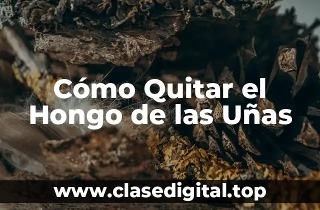 Causas del Hongo de las Uñas