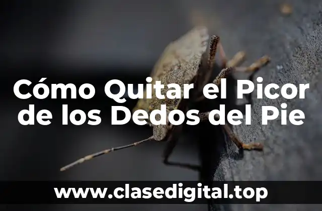 Cómo Quitar el Picor de los Dedos del Pie