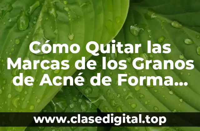 Cómo Quitar las Marcas de los Granos de Acné de Forma Efectiva