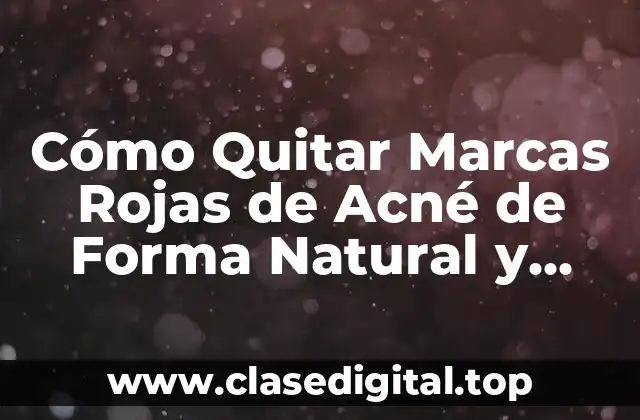 ¿Por qué Aparecen las Marcas Rojas de Acné?