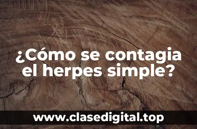 ¿Cómo se contagia el herpes simple?