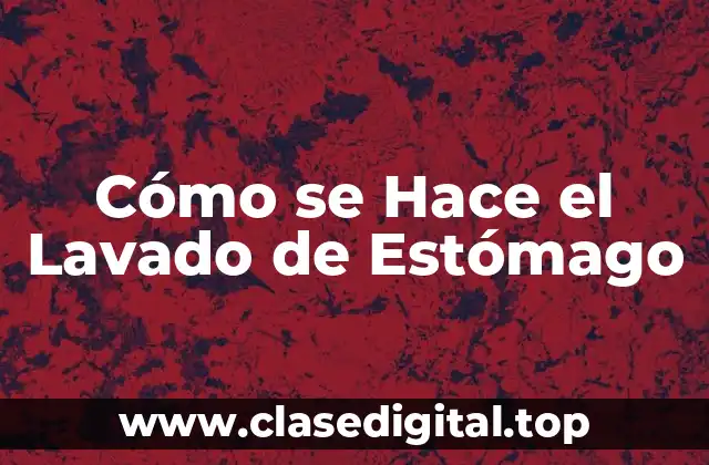Cómo se Hace el Lavado de Estómago