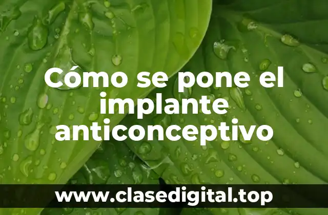 ¿Qué es un implante anticonceptivo?