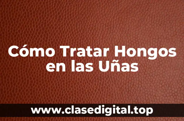 Cómo Tratar Hongos en las Uñas
