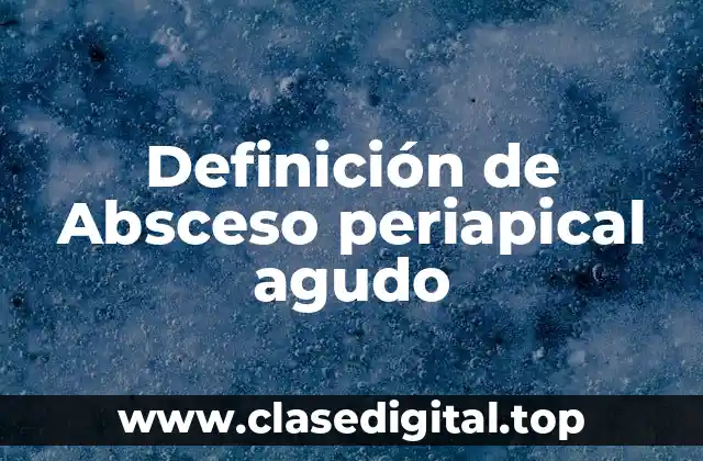 Definición de Absceso periapical agudo