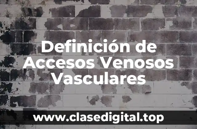 Definición de Accesos Venosos Vasculares