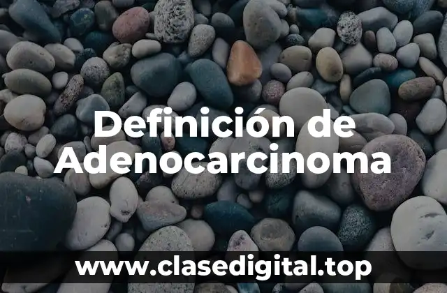 Definición de Adenocarcinoma
