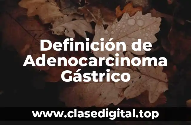 Definición de Adenocarcinoma Gástrico