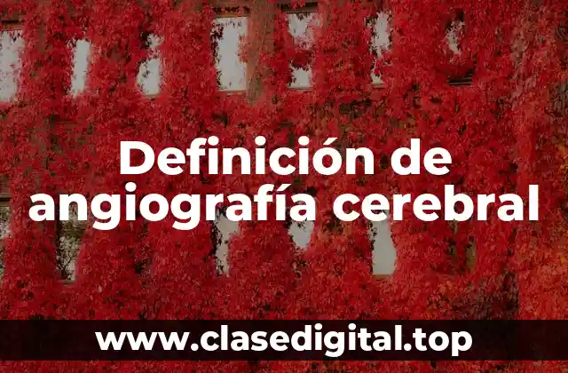 Ejemplos de angiografía cerebral