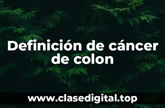 Definición de cáncer de colon
