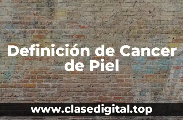 Definición de Cancer de Piel