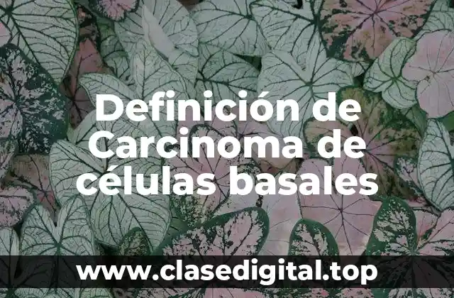 Definición de Carcinoma de células basales