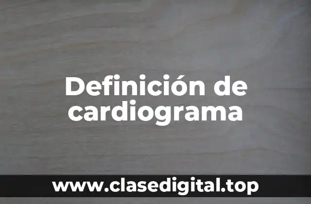 Definición de cardiograma