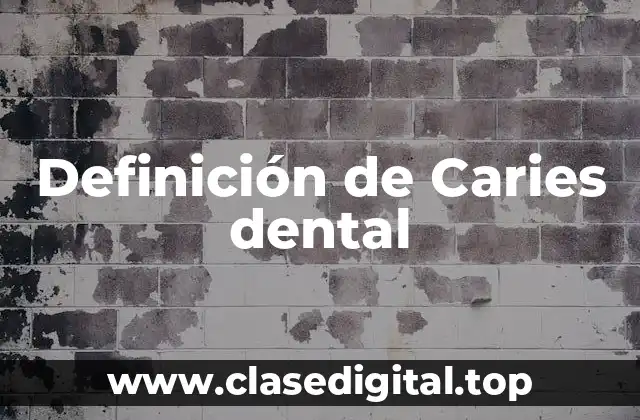 Definición de Caries dental