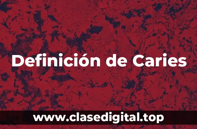 Definición de Caries