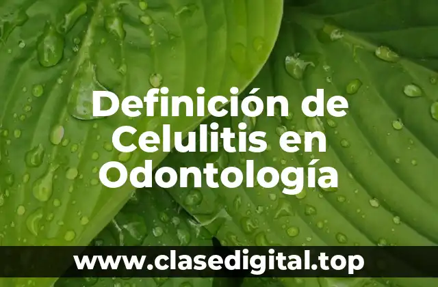 Definición de Celulitis en Odontología