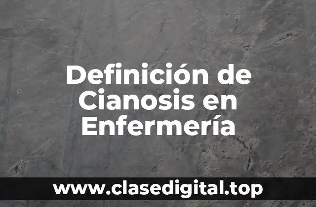 Definición de Cianosis en Enfermería