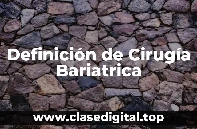 Definición de Cirugía Bariatrica