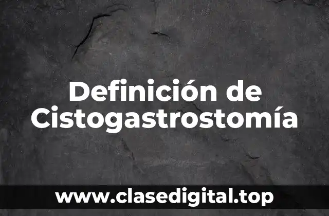 Definición de Cistogastrostomía