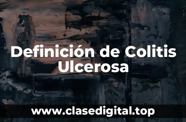Definición de Colitis Ulcerosa