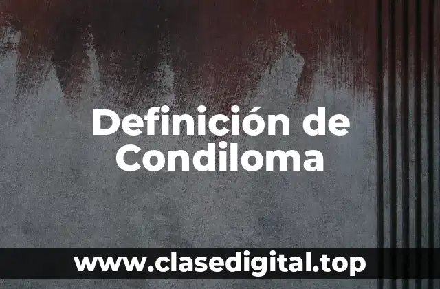 Definición de Condiloma