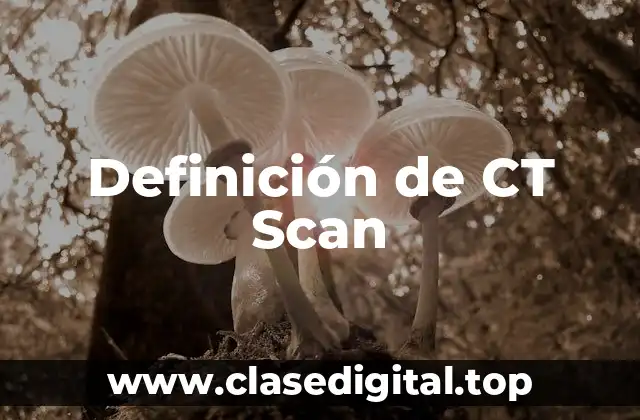 Definición de CT Scan