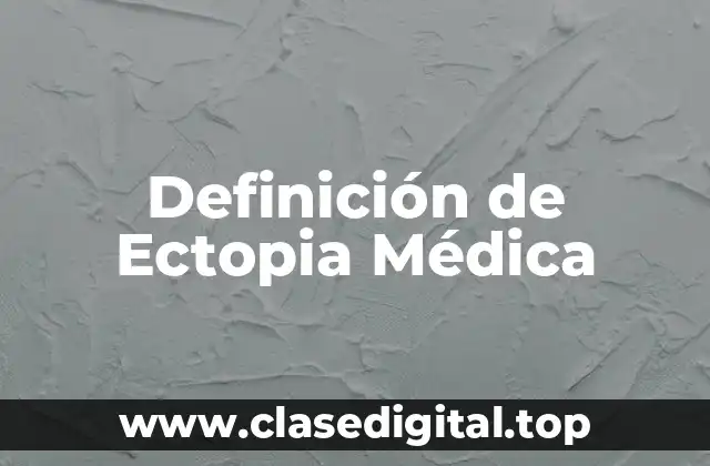 Definición de Ectopia Médica