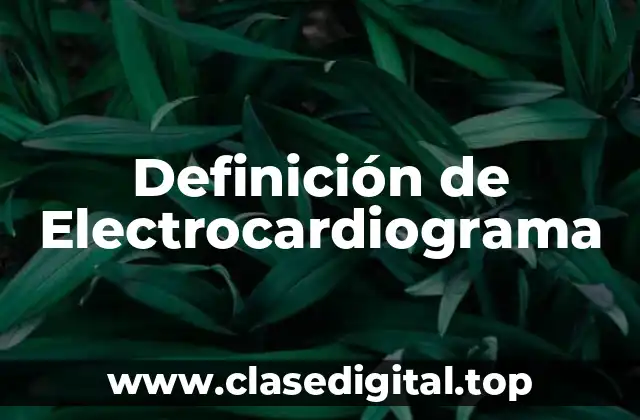 Definición de Electrocardiograma