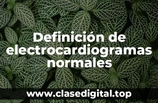 Definición de electrocardiogramas normales