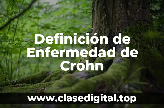 Definición de Enfermedad de Crohn