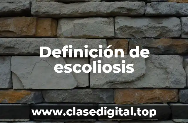Definición de escoliosis