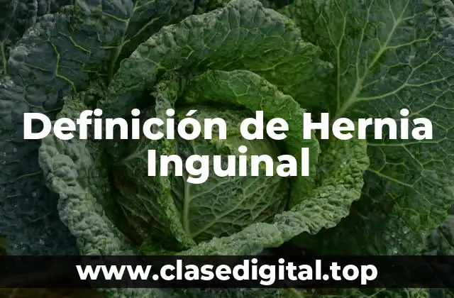 Definición de Hernia Inguinal