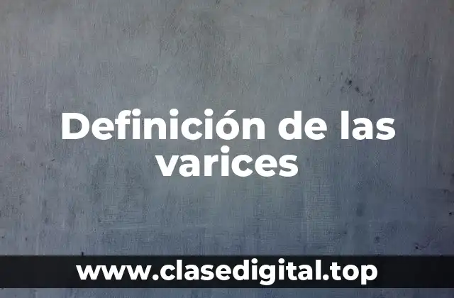 Definición de las varices