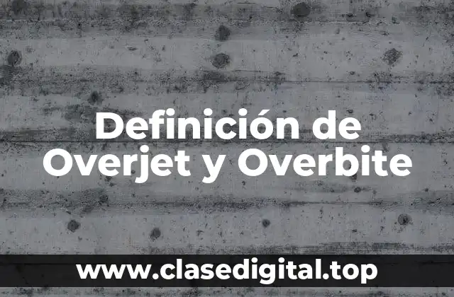 Definición técnica de Overjet