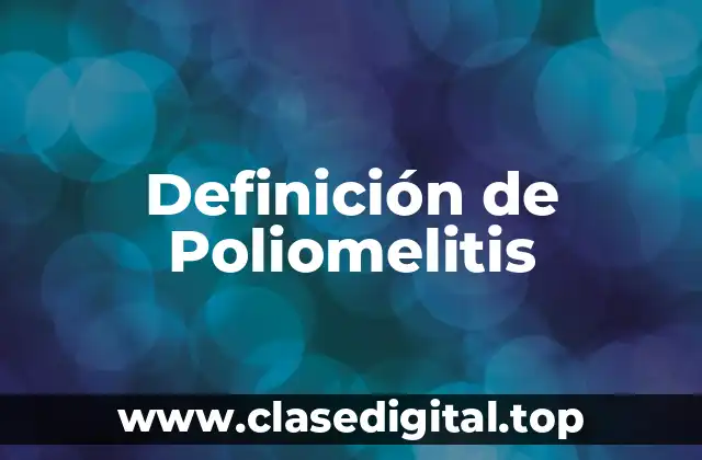 Definición de Poliomelitis