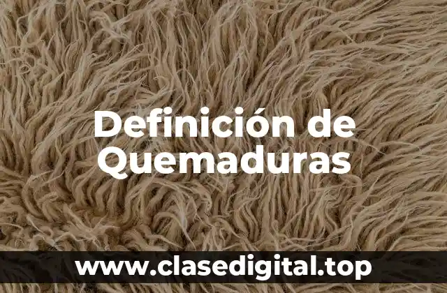 Definición de Quemaduras