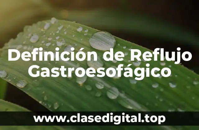 Definición de Reflujo Gastroesofágico