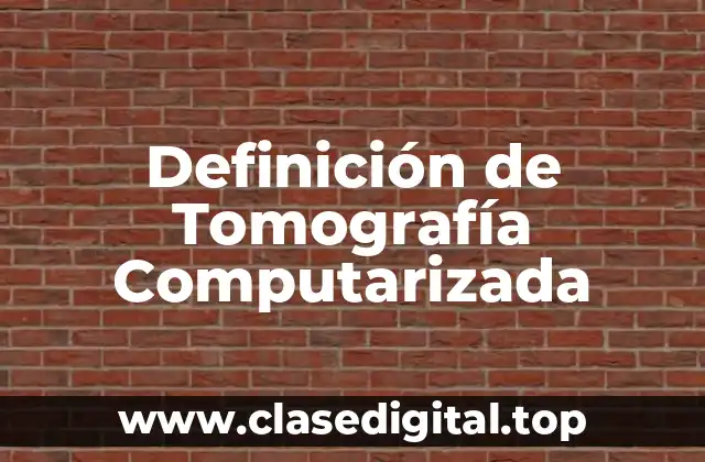 Definición de Tomografía Computarizada