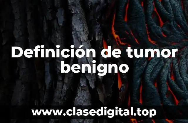 Definición de tumor benigno