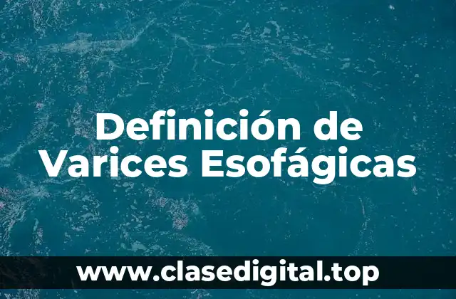 Definición Técnica de Varices Esofágicas