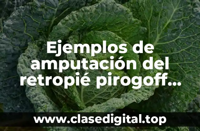 Ejemplos de amputación del retropié pirogoff ricard y malgaigne