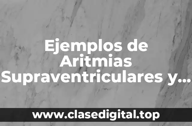 Ejemplos de Aritmias Supraventriculares y Significado